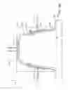 Fig. 16 - APPARATUS, SYSTEM AND METHOD FOR TREATING FAT TISSUE