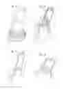 Fig. 03 - Irradiation device