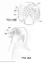 Fig. 45 - Light therapy platform combination mask