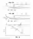 Fig. 16 - System and method for optogenetic therapy