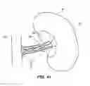 Fig. 35 - System and method for optogenetic therapy