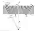 Fig. 01 - Collimator for redirecting compton scattered radiation in stereotactic radiosurgery