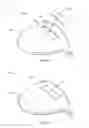 Fig. 30 - STABILIZING INSERT FOR A GOLF CLUB HEAD