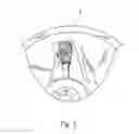 Fig. 03 - ADJUSTMENT TOOL OF SPRING PRELOADED ADJUSTMENT RING