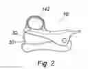 Fig. 03 - Hair Bang Clipper