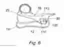 Fig. 10 - Hair Bang Clipper