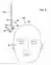 Fig. 04 - Adjustably positionable razor assembly