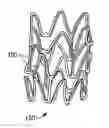 Fig. 01 - Tapered polymeric stent and method of fabricating same