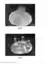 Fig. 08 - Acceleration of stereolithography