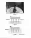 Fig. 10 - Acceleration of stereolithography
