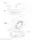 Fig. 02 - Preformed block piece with three points of support