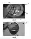 Fig. 06 - Heated light enclosure having an adaptable heating system