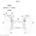 Fig. 02 - Structure for reinforcing front vehicle body