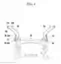 Fig. 05 - Structure for reinforcing front vehicle body