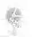 Fig. 01 - Bicycle rear derailleur with a damper assembly