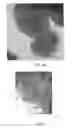 Fig. 04 - Applications for inorganic fullerene-like particles