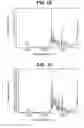 Fig. 16 - Forms of [R-(R*,R*)]-2-(4-fluorophenyl)-β, δ-dihydroxy-5-(1-methylethyl)-3-Phenyl-4-[(phenylamino)carbonyl]-1H-pyrrole-1-heptanoic acid calcium salt (2:1)