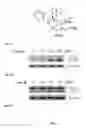 Fig. 02 - Synthesis of autophagy inducing compound and the uses thereof