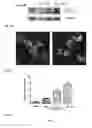 Fig. 03 - Synthesis of autophagy inducing compound and the uses thereof