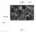 Fig. 05 - Synthesis of autophagy inducing compound and the uses thereof