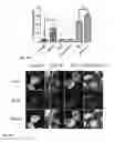 Fig. 06 - Synthesis of autophagy inducing compound and the uses thereof