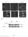 Fig. 14 - Synthesis of autophagy inducing compound and the uses thereof