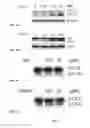 Fig. 16 - Synthesis of autophagy inducing compound and the uses thereof