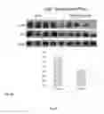 Fig. 19 - Synthesis of autophagy inducing compound and the uses thereof