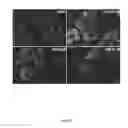 Fig. 24 - Synthesis of autophagy inducing compound and the uses thereof