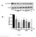 Fig. 27 - Synthesis of autophagy inducing compound and the uses thereof