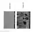 Fig. 11 - Controlled cross-linking processing of proteins