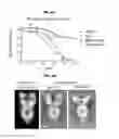 Fig. 08 - Prefusion RSV F proteins and their use