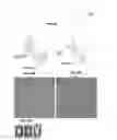 Fig. 37 - Prefusion RSV F proteins and their use