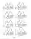 Fig. 12 - LOW MOLECULAR WEIGHT SILK COMPOSITIONS AND STABILIZING SILK COMPOSITIONS