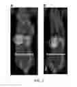 Fig. 03 - RADIOTRACER IMAGING USING SODIUM IODIDE SYMPORTER POLYPEPTIDES