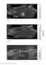 Fig. 06 - RADIOTRACER IMAGING USING SODIUM IODIDE SYMPORTER POLYPEPTIDES