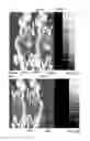 Fig. 07 - RADIOTRACER IMAGING USING SODIUM IODIDE SYMPORTER POLYPEPTIDES