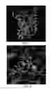 Fig. 09 - RADIOTRACER IMAGING USING SODIUM IODIDE SYMPORTER POLYPEPTIDES