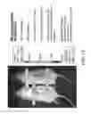 Fig. 17 - Vectors and methods to treat ischemia
