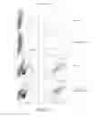 Fig. 12 - Modified T cell comprising a polynucleotide encoding an inducible stimulating molecule comprising MyD88, CD40 and FKBP12
