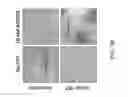 Fig. 58 - Modified T cell comprising a polynucleotide encoding an inducible stimulating molecule comprising MyD88, CD40 and FKBP12
