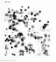 Fig. 30 - Methods of treating malignant tumors
