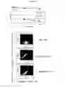Fig. 16 - KIR-binding agents and methods of use thereof