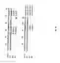 Fig. 02 - Methods for the Treatment of Autoimmune Disorders Using Immunosuppressive Monoclonal Antibodies with Reduced Toxicity
