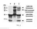 Fig. 04 - Chimeric antigen receptors with an optimized hinge region