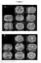 Fig. 33 - Endophytes and related methods