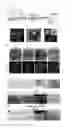 Fig. 08 - Method for preparing chondrocytes