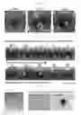 Fig. 11 - Method for preparing chondrocytes