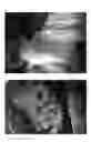 Fig. 12 - Method for preparing chondrocytes