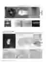Fig. 15 - Method for preparing chondrocytes
